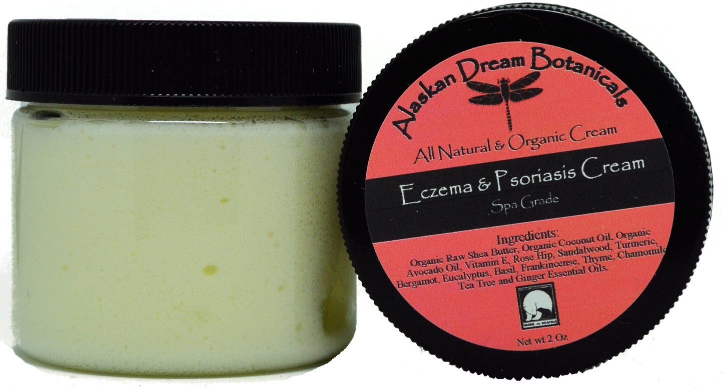 Eczema & Psoriasis Cream - Alaskan Dream Botanicals