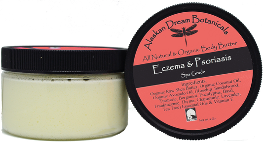 Eczema & Psoriasis Cream - Alaskan Dream Botanicals